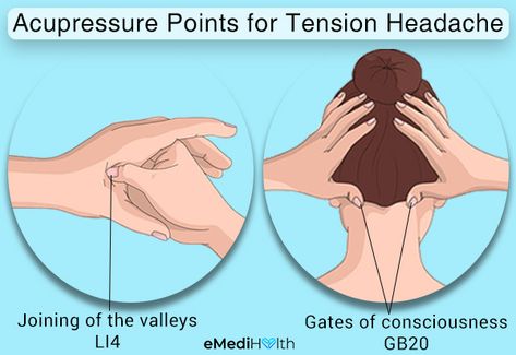 How to Manage Tension Headaches at Home - eMediHealth Tension Headache Relief, Relieve Tension Headache, Throbbing Headache, Migraine Attack, Migraine Prevention, Chronic Migraines, Tension Headache, Headache Relief, Muscle Spasms