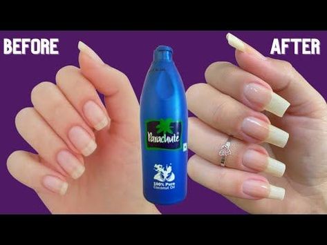 How To Grow Nails Faster How To Get Straight Legs Fast, How To Whiten Nails, White Spots On Nails, Make Nails Grow, Nail Growth Faster, Fast Drying Nail Polish, Grow Long Nails, Nail Whitening, Nail Growth Tips