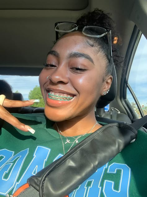 b Teal Braces Aesthetic, Braces On Brown Skin, Green Braces On Black People, Light Green Braces, Teal Braces On Black People, Teal Power Chain Braces, Braces Colors Ideas Brown Skin, Braces Dark Skin, Cute Braces Colors For Brown Skin