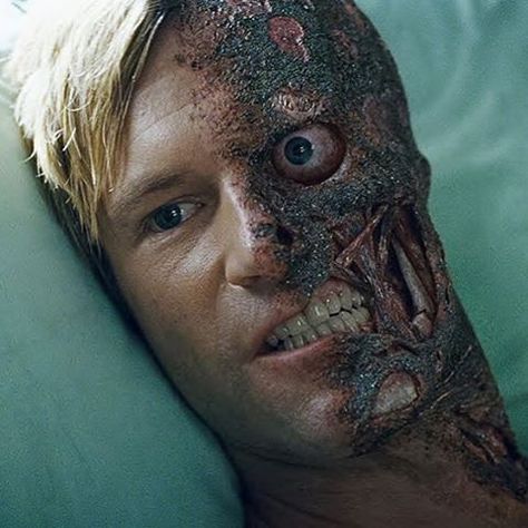 Harvey Dent. - - - - - - - - - - - Two Face Dark Knight, Two Faced Cat, Batman Film, Harvey Dent, The Dark Knight Trilogy, Wade Wilson, Two Face, Batman Begins, Dc Villains