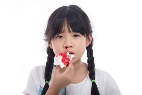 Stop Nose Bleeds, Natural Nose, Nose Picking, Nose Bleeds, Healthy Fruit, Respiratory Infection, Signs And Symptoms, Blood Vessels, Fruit Recipes