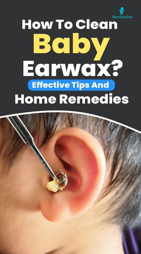 New mothers may often wonder if it is necessary to and how to clean earwax in babies. Earwax is important, and therefore it is not important to remove it. However, thick and hardened ear wax can cause ear pain. Cleaning Ears Wax How To Remove, How To Get Ear Wax Out Of Your Ear, How To Remove Wax From Ears, How To Clean Ear Wax Out, Sweet Oil For Ears, Ear Wax Removal Impacted, Natural Ear Wax Removal, Clean Ear Wax Out, Impacted Ear Wax