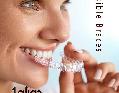 Invisalign Aligners, Straight Smile, Invisalign Braces, Implant Dentist, Traditional Braces, Clear Braces, Dental Surgeon, Crooked Teeth, Teeth Straightening