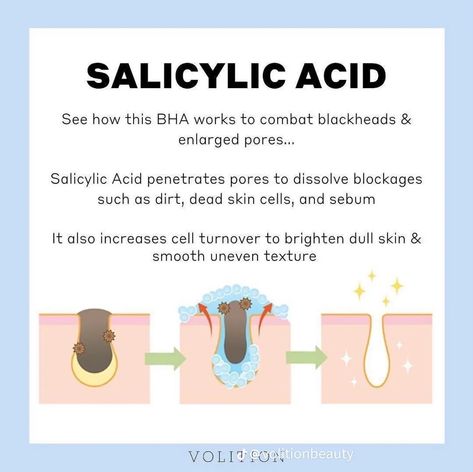 Salicylic Acid Benefits, Skin Facts, Skin Care Business, Skin Advice, Serious Skin Care, Good Skin Tips, Basic Skin Care Routine, Acne Control, Taking Advantage