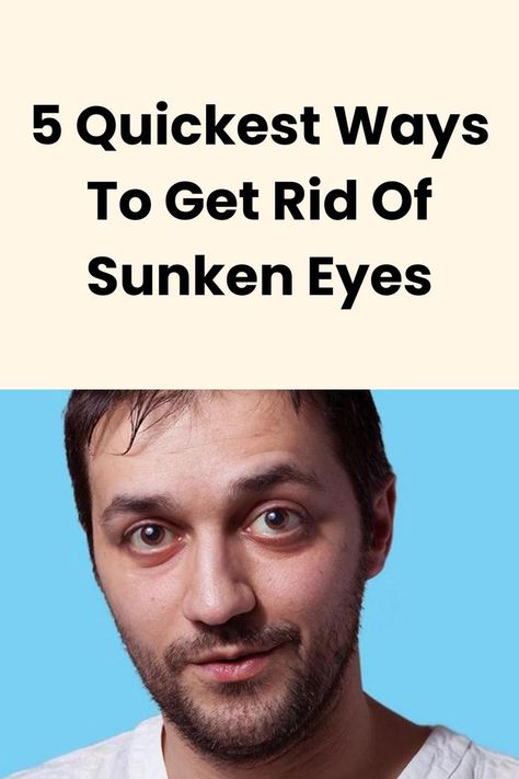 How To Get Rid Of Sunken Under Eyes, How To Get Rid Of Sunken Eyes, Sunken Under Eyes Remedies, Puffy Eyes Remedy How To Get Rid, Sunken Eyes Remedy, Sunken In Eyes, Sunken Under Eyes, Baggy Eyes Remedy, Sunken Eyes Makeup