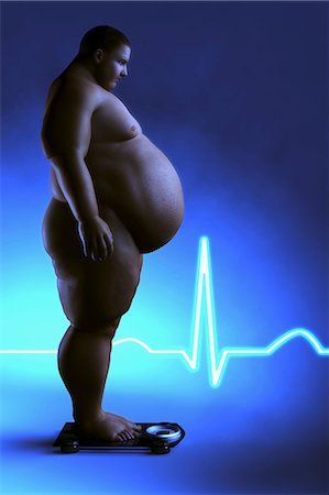 fat people on scale - Obese person standing in front of an electrocardiogram representing the negative effects of this medical condition. Stock Photo - Rights-Managed, Code: 875-06575660 Angry Girl, Obese People, Fat Man, Egypt Travel, Pose Reference Photo, Pose Reference, Medical, Resolution, Coding