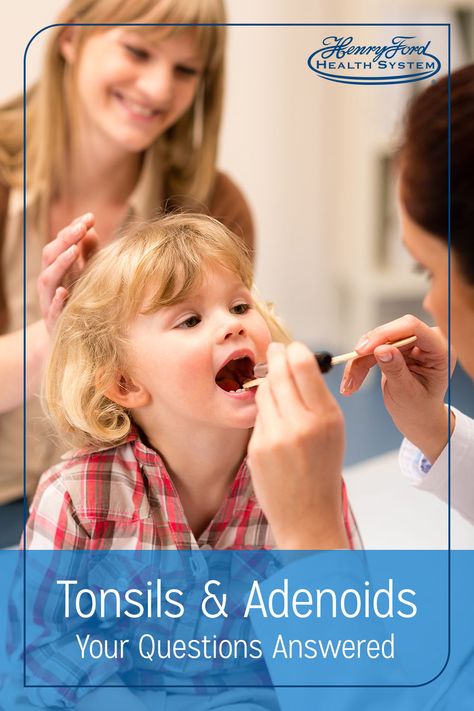 Your tonsils and adenoids act as a reservoir for bacteria. They create antibodies to protect you from infections, but a buildup of bacteria can lead to sleep apnea or reoccurring strep throat. Having your tonsils removed was once common, but now doctors are more selective about the procedure. Tonsillitis Symptoms, Enlarged Tonsils, Tonsils And Adenoids Surgery Kids, Remedies For Tonsillitis, Tonsils And Adenoids, Gum Recession, Best Healthy Diet, Strep Throat, Canker Sore