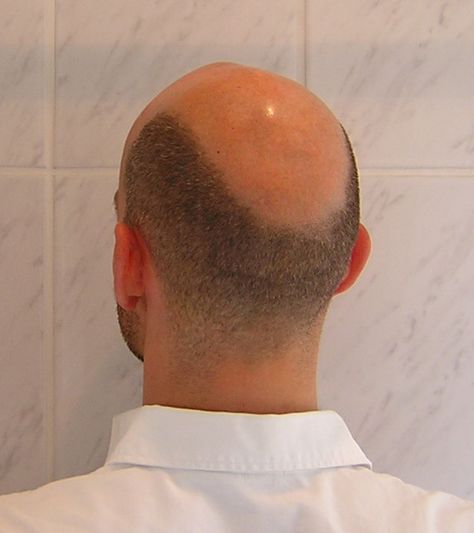 Bald Bearded Tattooed Men, Male Pattern Baldness Hairstyles, Horseshoe Haircut, Bald Head Man, Bald People, Shave Your Head, Bald Guy, Red Hair Men, Bald Men Style