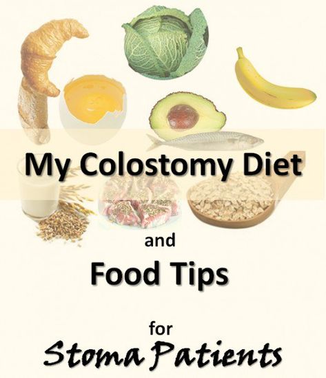 Is there a special colostomy diet for stoma patients? If you have an ostomy, you probably want to know if you have to make major changes to your regular diet, or not. As an ex-colostomy patient, I can only tell you of my experience and the nutritional pattern I followed. Ostomy Life, Ostomy Care, Ostomy Bag, Diet Guide, Fitness Challenge, Special Diets, Foods To Avoid, Calorie Intake, Food Tips