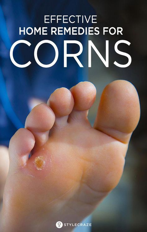 Get Rid Of Corns, Home Remedies For Colds, Natural Remedies For Headaches, Libido Boost For Men, Corn Removal, Oil Image, Warts Remedy, Libido Boost, Ginger Benefits