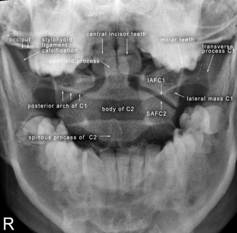 Radiology Student Study, Radiography Student, Radiology Student, Radiology Technician, Radiology Imaging, Radiology Tech, Radiology Technologist, Tech Aesthetic, Xray Tech