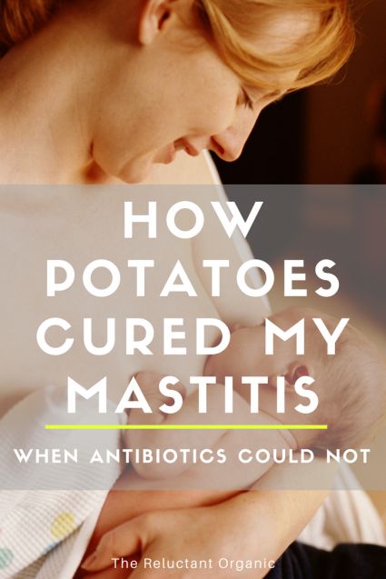 Mastitis Remedies At Home, Bf Tips, Mastitis Remedies, Blocked Milk Duct, Birth Prep, Clogged Duct, Natural Antibiotic, Natural Antibiotics, Post Partum