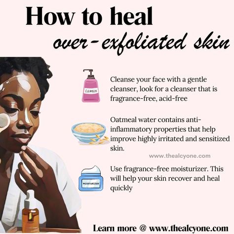 How to heal over-exfoliated skin when you have exposed your skin barrier. These tips will help you get started to healing your skin after exfoliating too much and too frequently with lots of exfoliating acids, scrubs and whatnot. Learn more on over-exfoliation on this post https://thealcyone.com/signs-of-over-exfoliation-and-how-to-restore-your-skin/ #exfoliate #exfoliation #exfoliating #exfoliatingsoap #exfoliatingtoner #exfoliateyourskin #exfoliatingscrub #exfoliateyourskin How To Use Exfoliator, What To Use To Exfoliate Skin, Exfoliate And Moisturize, What Is Exfoliating, What Does Exfoliate Mean, Fragrance Free Moisturizer, Exfoliating Toner, Exfoliating Soap, Skin Cleanse