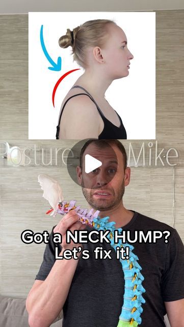 Neck Hump Correction, Hump Correction, Dowager Hump, Back Hump, Dowager's Hump, Neck Hump, Posture Fix, My Humps, Back Stretching