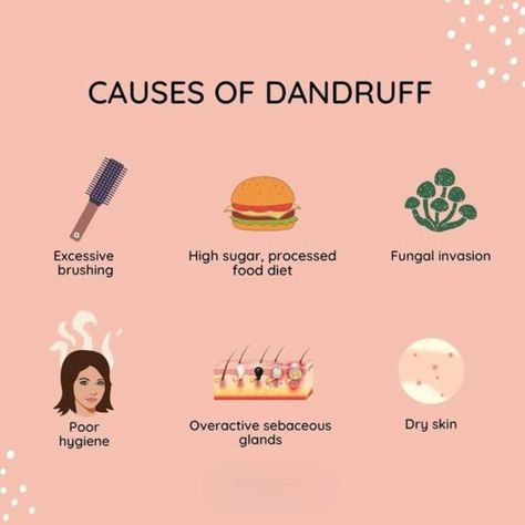 Hair Mask For Dandruff, Dandruff Hair, Dandruff Remedy, Healthy Hair Routine, Getting Rid Of Dandruff, Haircare Tips, Hair Dandruff, Hair Mistakes, Healthy Hair Tips