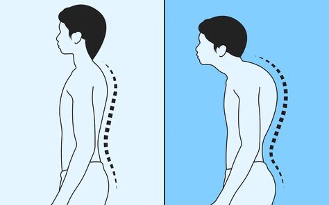 Dowager’s hump: What is it and how to get rid of it? Dowager's Hump, Tech Neck, Strengthen Core, Bad Posture, Medical Terms, Poor Posture, Be Aware, Bone Health, Neck Pain