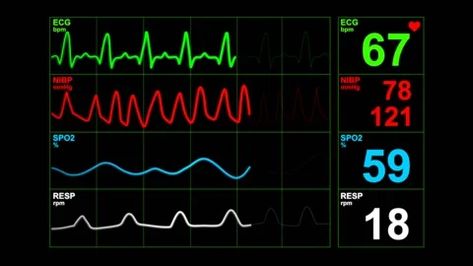 Health Widget, Vital Signs Chart, Vital Signs Monitor, Nurse Aesthetic, Medical Instruments, Vital Signs, School Study Tips, School Study, Illustration Character