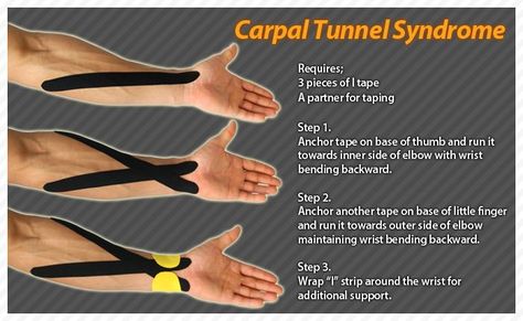 Carpal Tunnel Exercises, Carpel Tunnel, Carpal Tunnel Relief, K Tape, Kinesio Tape, Kt Tape, Kinesio Taping, Kinesiology Taping, Muscle Anatomy