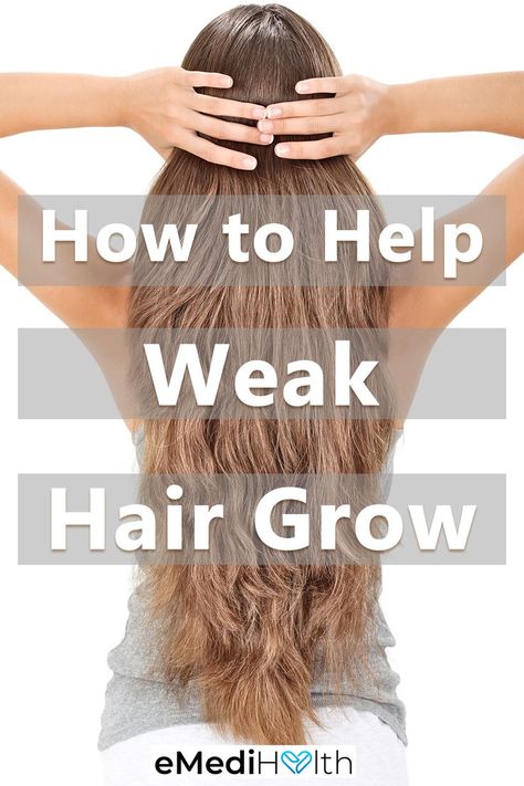 Weak hair doesn’t have to be a lifetime problem. Promote the growth of strong hair by doing the following: Strong Hair Remedies, Hair Growth Foods, Bald Patches, Hair Growth Cycle, Diet Lifestyle, Weak Hair, Blemish Remover, Regrow Hair, Grow Long Hair