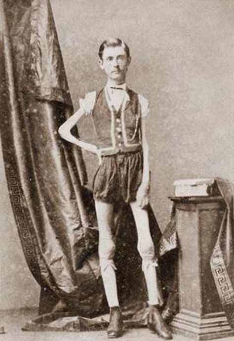 Isaac Sprague, The Living Skel... is listed (or ranked) 4 on the list Every Single Human Attraction From P.T. Barnum's Freak Show Vintage Sideshow, Circus People, Pt Barnum, Circus Freaks, Old Circus, Barnum Bailey Circus, Human Oddities, Circus Sideshow, Creepy Vintage