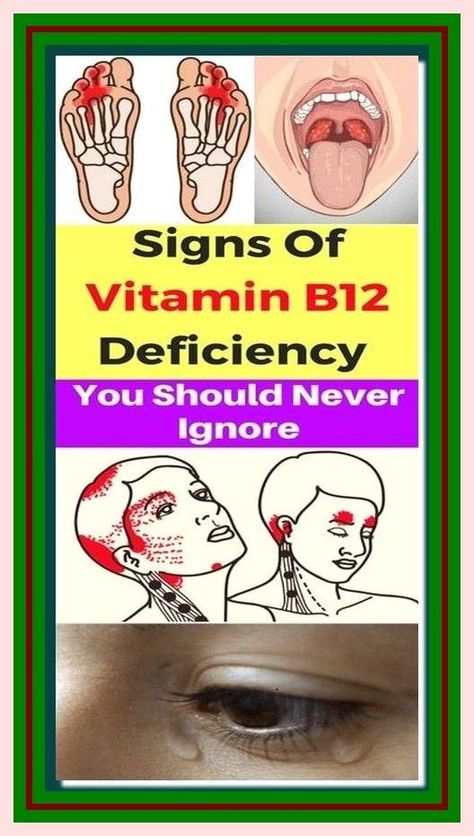 I won’t forget it. Overwhelming info! Vitamin B12 Deficiency Symptoms, Fingerfood Recipes, B12 Deficiency Symptoms, Tips For Mental Health, Healthy Whole Food Recipes, Deficiency Symptoms, Health For Women, B12 Deficiency, Vitamin B12 Deficiency