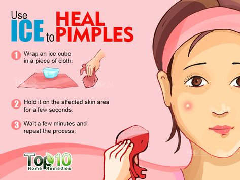 Chest Acne, Get Rid Of Pimples, Rid Of Pimples, Forehead Acne, Top 10 Home Remedies, Natural Acne Remedies, Natural Acne, Home Remedies For Acne, How To Get Rid Of Pimples