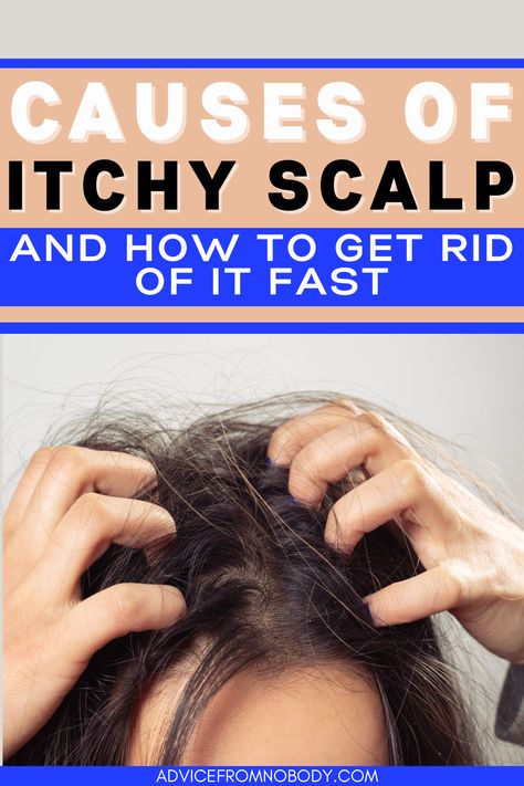 We share why there are so many causes of an itchy scalp and why it can be hard to find the exact reason from psoriasis, eczema, dandruff, and other causes. Plus, some of the most common factors for an itchy scalp and what you can do about it. Experiencing an itchy scalp? Here are some of the causes and remedies. Remedies For Dandruff And Itchy Scalp, Itchy Hair Scalp Treatments, How To Help Itchy Scalp, Flaky Hair Remedies Dry Scalp, Soothe Itchy Scalp, Scalp Dryness Remedies, Dandruff And Itchy Scalp Remedy, Natural Remedies For Itchy Scalp, Dry Scalp Oily Hair Remedy