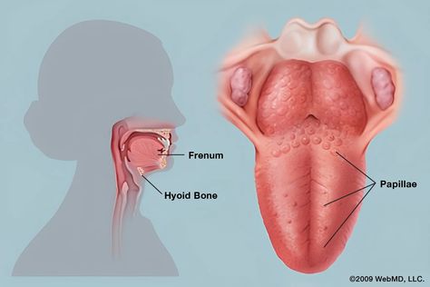 Tongue Problem Basics Tongue Tie Symptoms, Bumps On Tongue, Tongue Problems, Tongue Tie, The Tongue, Oral Health, Quick Saves