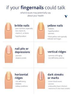 Often, our hair, skin, and nails reflect our interior health. Here are six common fingernail issues—and what they’re trying to tell you about your health. Nail Health Signs, Fingernail Health, Emerald Nails, Opal Nails, Health Signs, Peinados Recogidos, Brittle Nails, Nail Growth, Nail Fungus