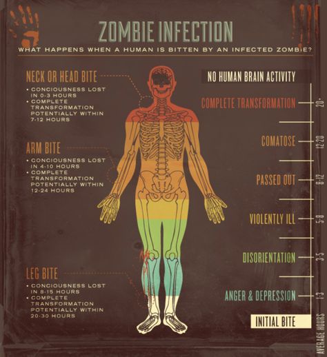 What happens to you after a zombie bite Zombies Apocalypse Survival, Zombie Apocalypse Party, Zombie Survival Guide, Zombie Apocolypse, Apocalypse Aesthetic, Zombie Attack, Survival Skills Life Hacks, Apocalypse Art, Survival Life Hacks