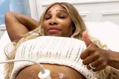 Serena Williams Reveals Tummy-Tightening Procedure but Says 'I Will Always Love My Birthing Scars' Tummy Tightening, Skin Tightening Procedures, Emergency C Section, Skin Tightening Treatments, Beauty Procedures, Cleveland Clinic, Never Be The Same, Post Pregnancy, Self Conscious