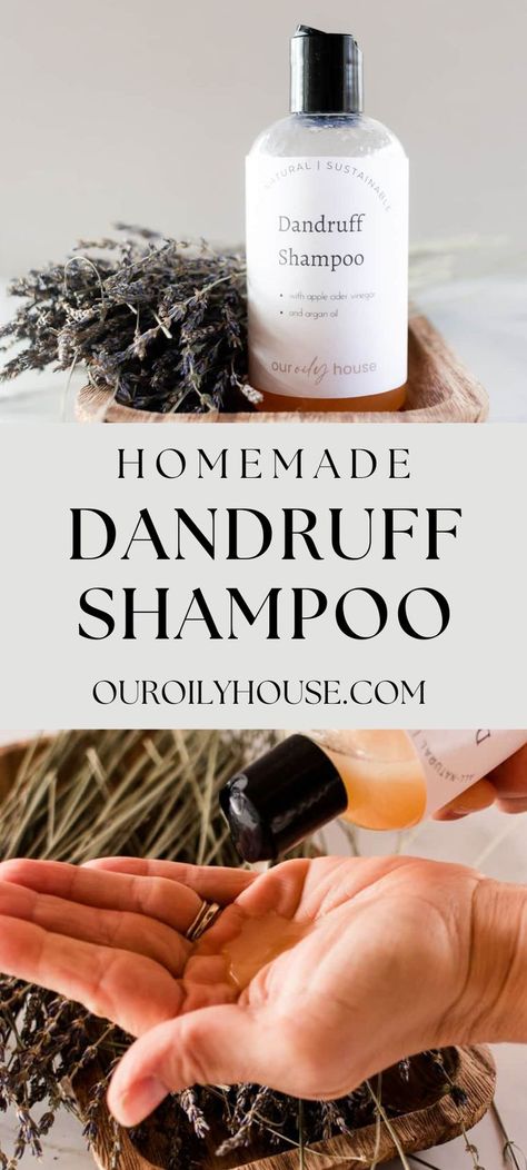 Natural House Cleaners, Our Oily House, How To Make Shampoo, Diy Shampoo Recipe, Natural Dandruff Remedy, Best Hair Conditioner, Oils For Dandruff, Diy Conditioner, Baking Soda For Hair