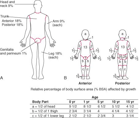 Table: (A) Rule of nines (for adults) and (B) Lund-Browder chart (for children) for estimating extent of burns - MSD Manual Professional Edition Rule Of Nines, Treat Burns, Education Certificate, Board Exam, Wound Care, Medical Knowledge, Med School, Life Improvement, Head And Neck