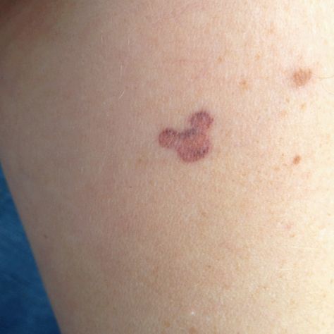 A Hidden Tattoo...The ultimate hidden Mickey Mouse tattoo. Hidden Mickey Tattoo Ideas, Hidden Mickey Tattoo, Tiny Disney Tattoo, Hidden Tattoo, Brown Tattoo Ink, Teardrop Tattoo, Brown Tattoo, Mickey Tattoo, Mouse Tattoo