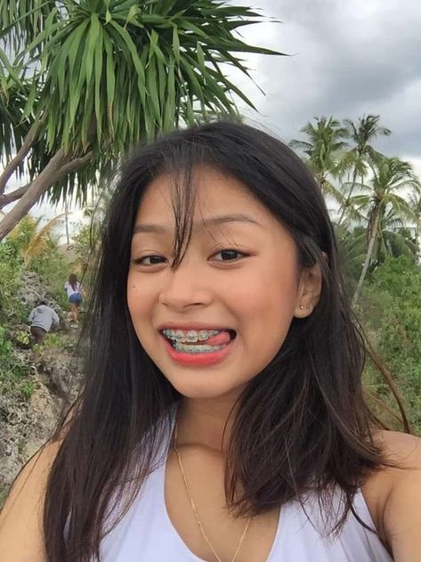 Perfect Teeth Braces, Behel Gigi, Girl With Braces, Braces Smile, Cute Braces Colors, Braces Tips, Braces Girls, Cute Braces