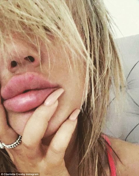 Big Lips Natural, Heart Shaped Lips, Lips Inspiration, Botox Lips, Maquillage On Fleek, Charlotte Crosby, Large Lips, Anime Lips, Revealing Dresses