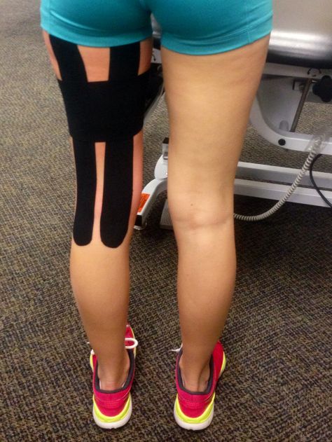 Taping for torn hamstring. @mlrusch  we should have done this for your hammy Kt Tape Hamstring, Torn Hamstring, K Tape, Foot Reflexology Massage, Kt Tape, Kinesio Taping, Sports Therapy, Workout Training Programs, Kinesiology Taping