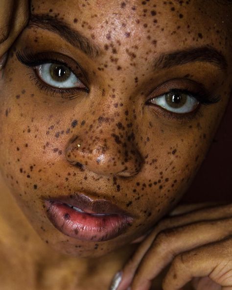 Freckled Goddess on Instagram: “Look me in the eyes and tell me you love me 😍 . . 📸: @slthephotog . . #editorial #editorialphotography #photography #photoshoot #tbt #model…” Freckles On Dark Skin, Henna Freckles, Black Girls With Freckles, Black Freckles, Big Lips Natural, Horrible Tattoos, People With Freckles, Master Tattoo, Women With Freckles