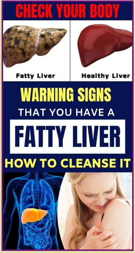 CHECK YOUR BODY: Warning Signs That You Have a Fatty Liver Ways and How to Cleanse It Quadrants Of The Abdomen, Itching Skin, Healthy Liver, Body Organs, Digestion Problems, Warning Signs, Home Remedies, How To Fall Asleep, Health Tips