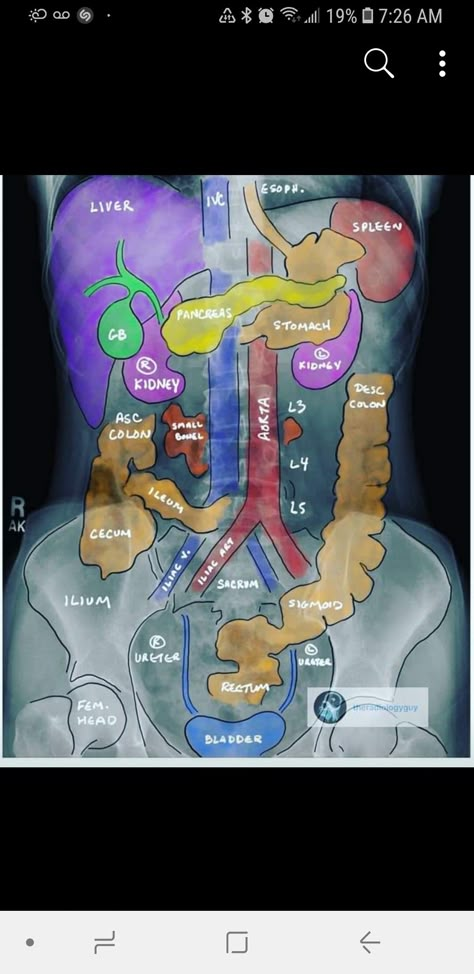 Assistant Aesthetic, Diagnostic Medical Sonography Student, Simple Nursing, Medical Radiography, Sonography Student, Radiology Student, Basic Anatomy, Diagnostic Medical Sonography, Radiology Imaging