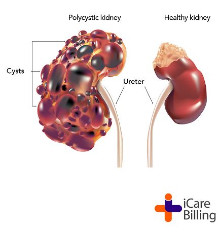 Diet Schedule, Polycystic Kidneys, Healthy Living Inspiration, Healthy Kidneys, Healthy Living Motivation, Liver Diet, Kidney Cleanse, Healthy Morning Routine, Kidney Health