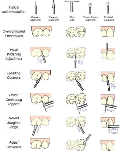 Dental Tools Names, Dental Assistant Study Guide, Dental Assistant School, Dental Pictures, Dental Assistant Study, Dental Hygiene Student, Dental Images, Kedokteran Gigi, Dental Exam