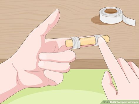 3 Ways to Splint a Finger - wikiHow Diy Thumb Splint, Diy Finger Splint, Broken Finger Splint, Fractured Finger, Jammed Finger, Thumb Splint, Advanced Cardiac Life Support, Finger Injury, Broken Finger