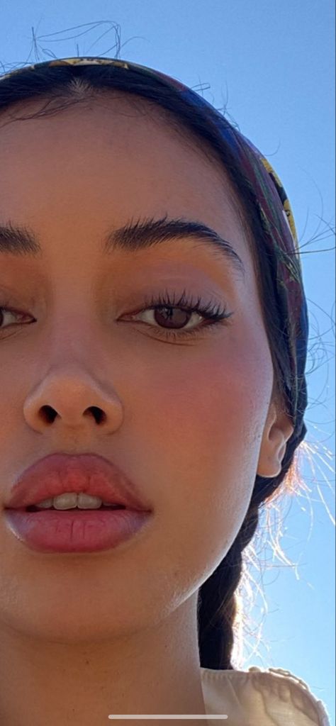 Cindy Kimberly Lip Fillers, Defined Nose Bridge, Slim Face Aesthetic Pictures, Keyhole Pout Lip Filler, Front Nose Profile, Big Pouty Lips, Keyhole Pout Lips, Lip Filler Pouty Lips, Nose Manifestation