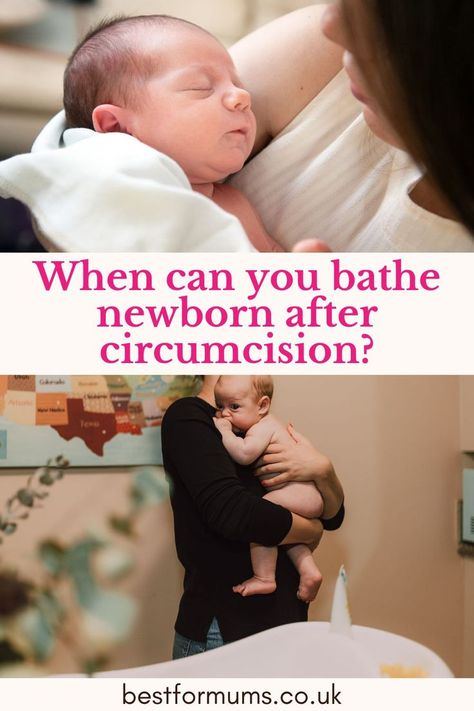 When Can you Bathe Newborn After Circumcision? When To Bathe Newborn, Circumcision Care Newborn, Strong Willed Child, Baby Gift Guide, Delivering A Baby, Introducing Solids, Sibling Rivalry, In Hospital, Common Questions