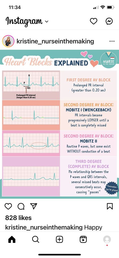 Nclex Cardiovascular, Cardiac Drips Cheat Sheets, Cardiovascular Disorders, Pr Interval, Nursing Cheat Sheet, Nursing Cheat, Nclex Study, Cardiovascular System, Nursing School Notes