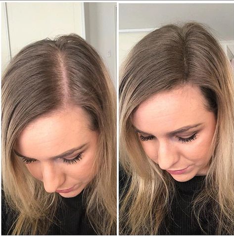 An instant solution for female hair loss. Conceal thinning hair, wider parts and greys with our BOOSTNBLEND 100% cotton hair fibres. This customer has used both BOOSTNBLEND and Rootz to get the perfect parting. Regrowth Hair, Hairstyle Mens, Zayn Malik Hairstyle, Losing Hair, Hairstyle For Short Hair, Hairstyle For Short, Hairstyle Videos, Hairstyle Men, Hair Adviser