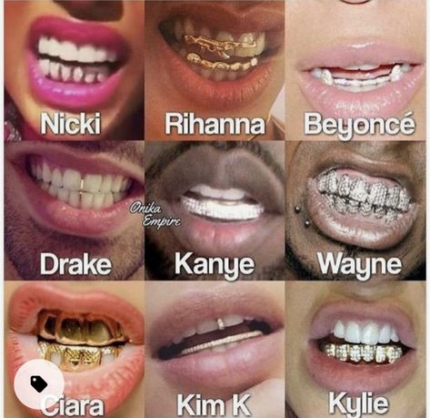 Teeth Aesthetic, Pretty Teeth, Grillz Teeth, Cute Braces, Diamond Teeth, Tooth Gems, Braces Colors, Loose Tooth, Gold Grillz