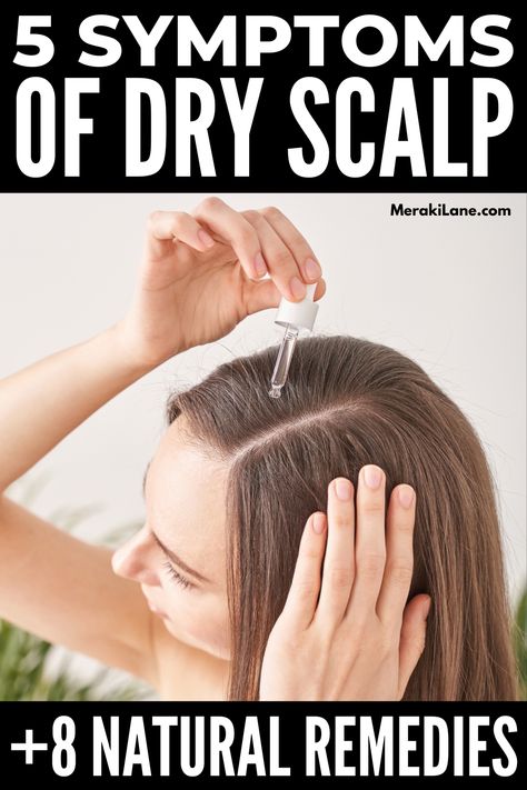 nail problems how to get rid Itchy Dry Scalp Remedy, Treat Dry Scalp, Flakey Scalp, Best Shampoo For Dandruff, Dry Hair Remedies, Itchy Scalp Remedy, Dry Scalp Remedy, Dry Flaky Scalp, Itchy Flaky Scalp