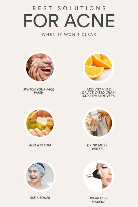 Wow Skin Science, Blind Pimple, Forehead Acne, Pimples Under The Skin, Acne Prone Skin Care, Prevent Pimples, Vegan Hair Care, Acne Skincare Routine, Good Skin Tips